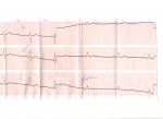 Кардиограмма_4